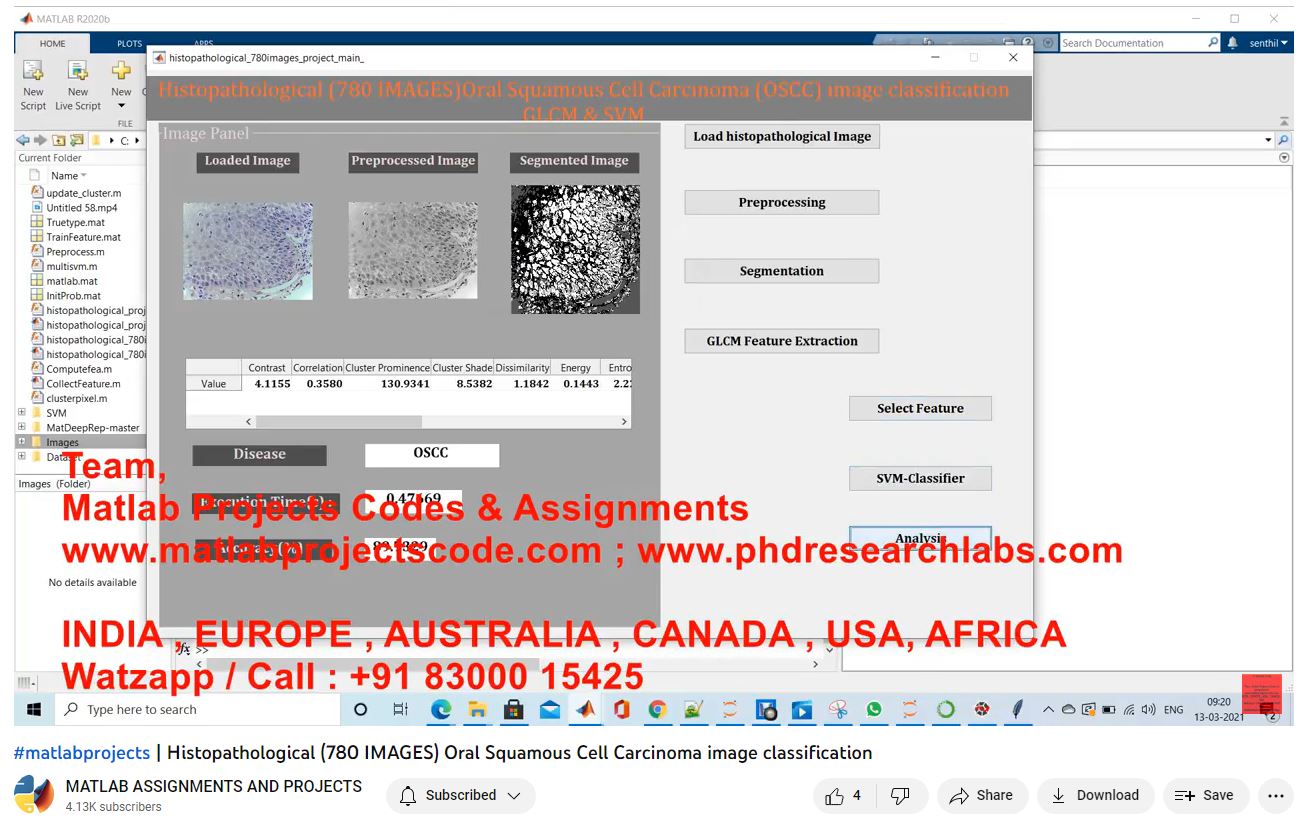 Histopathological 780 Images Oral Squamous Cell Carcinoma Image Classification project thumbnail image