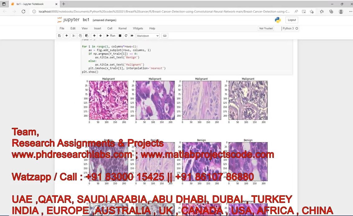 Histopathological Images For Prediction Of Breast Cancer Using Python Code _ Breast Cancer project simulation thumbnail for Signal Processing and AI Engineering