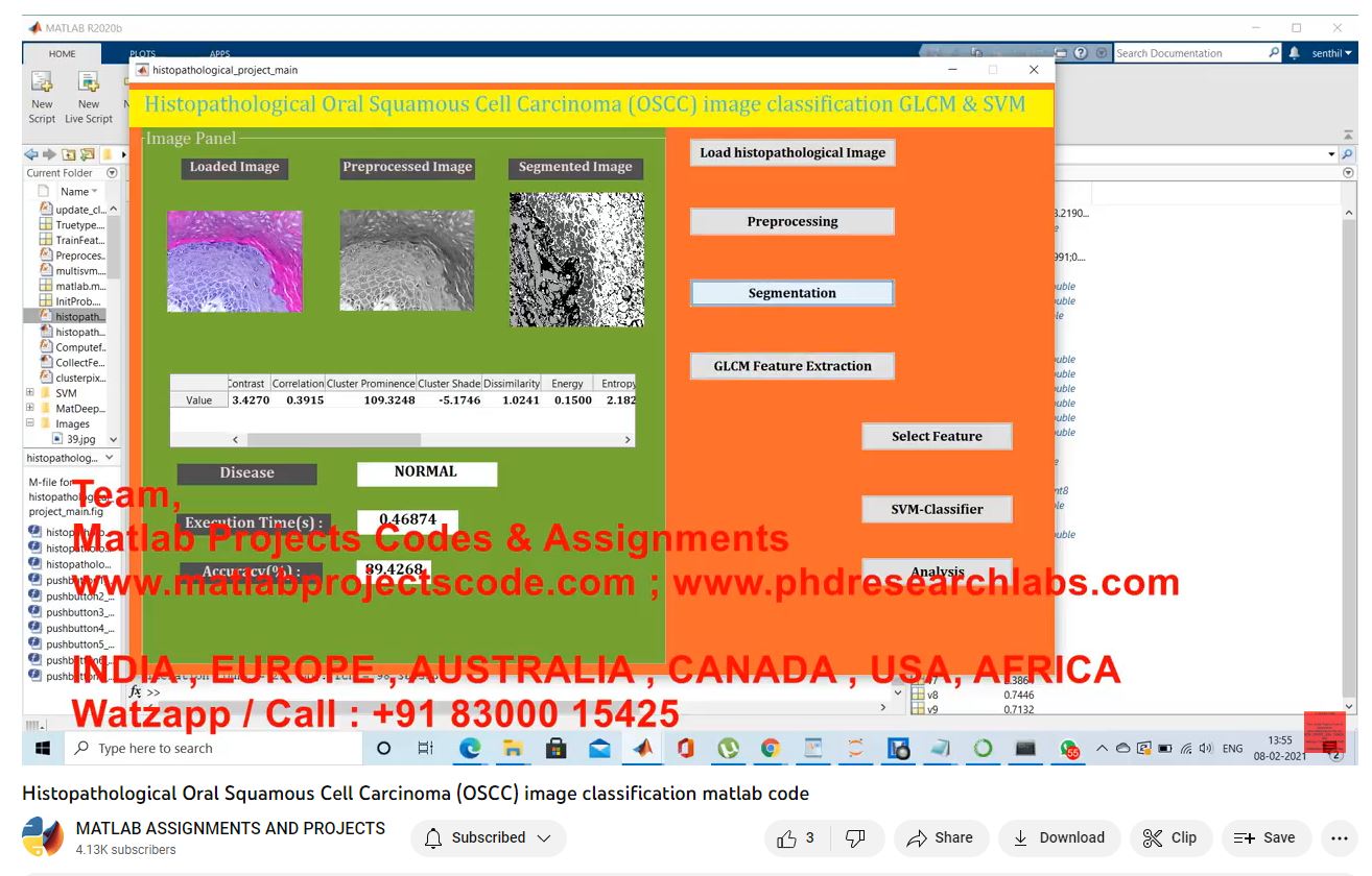 Histopathological Oral Squamous Cell Carcinoma Oscc Image Classification Matlab Code project thumbnail image