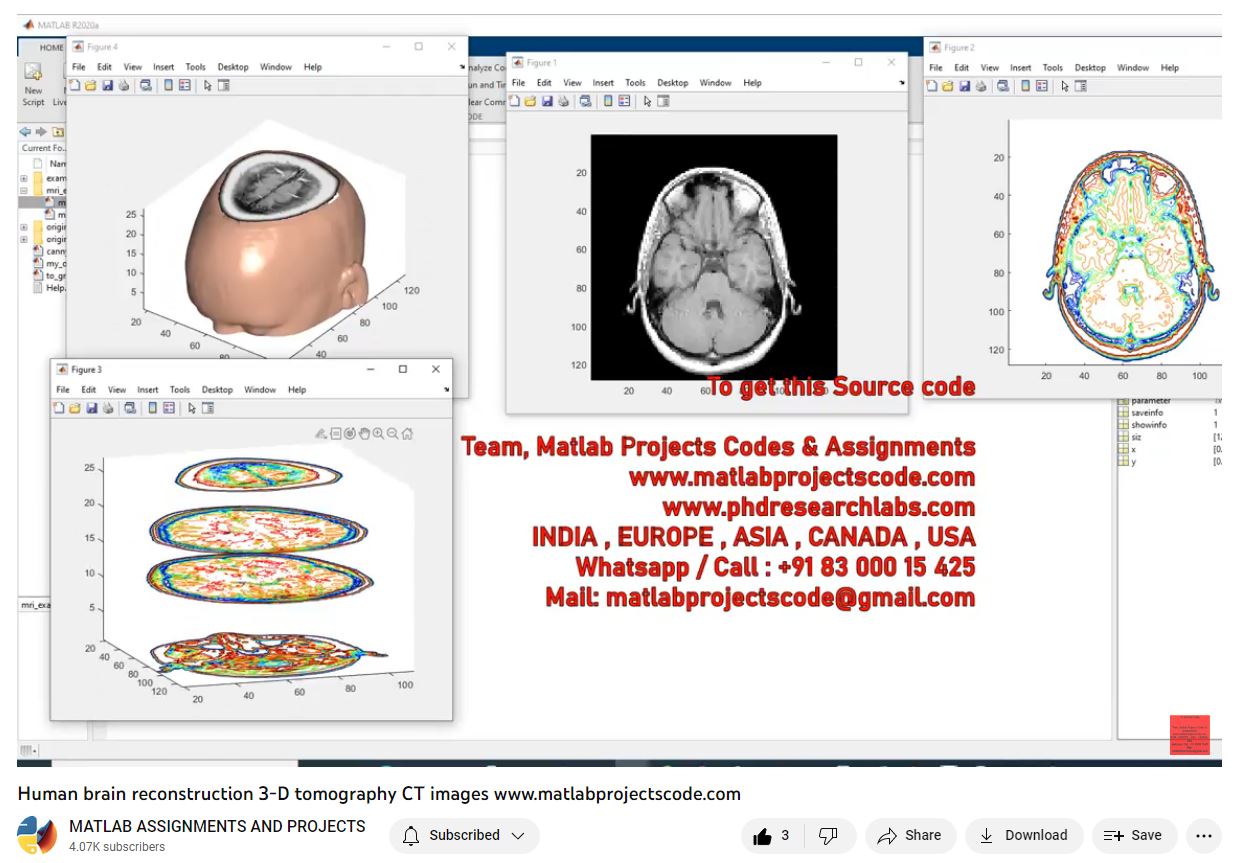 Human Brain Reconstruction 3-D Tomography Ct Images-Matlab Simulink-Electrical Assignments-Projects-Phd Research project simulation thumbnail for Signal Processing and AI Engineering