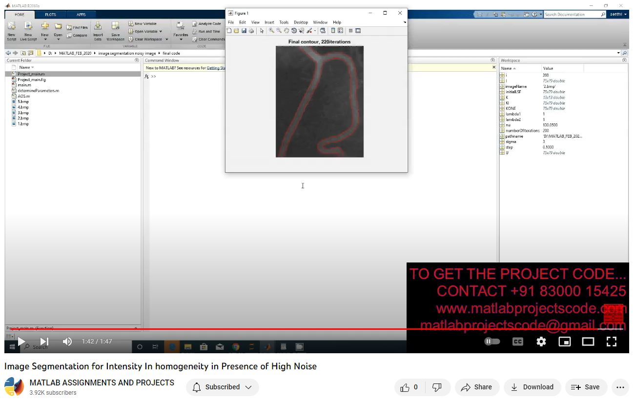Image Segmentation For Intensity In Homogeneity In Presence Of High Noise project simulation thumbnail for Signal Processing and AI Engineering