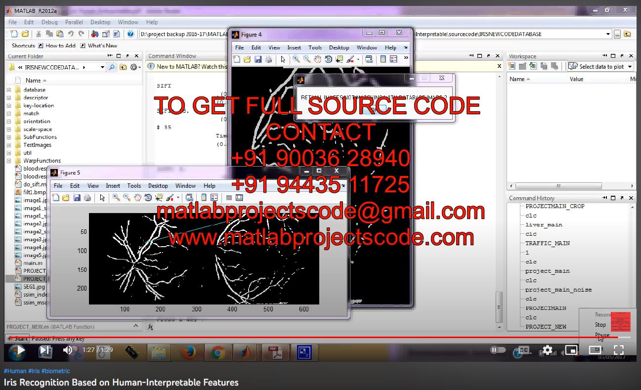 Iris Recognition based on | MATLAB Project