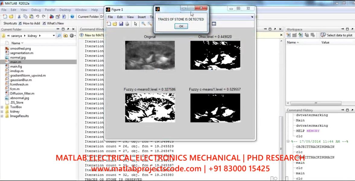 Irregularity Detection In Kidney Stone Ultrasound Imaging project simulation thumbnail for Signal Processing and AI Engineering
