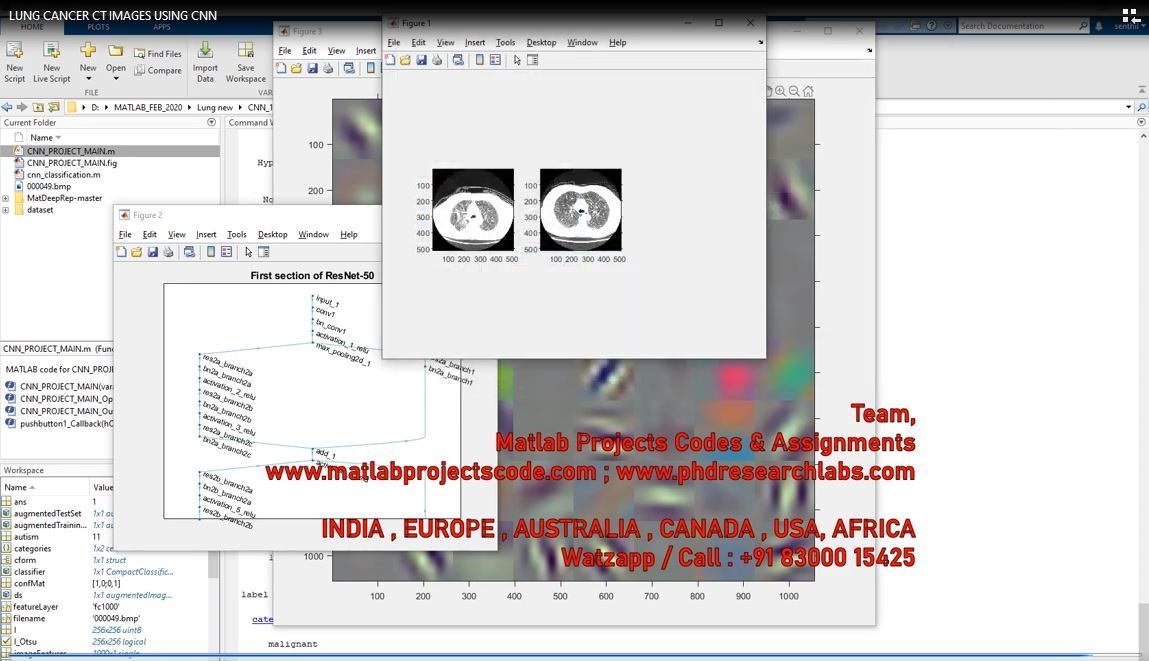 Lung Cancer Ct Images Using Cnn project simulation thumbnail for Signal Processing and AI Engineering