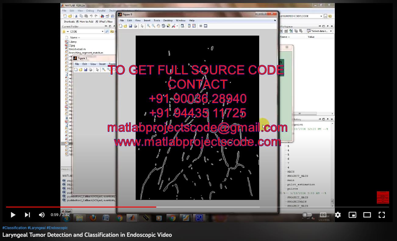 Laryngeal Tumor Detection and Classification in Endoscopic Video-MATLAB project simulation thumbnail for Signal Processing and AI Engineering