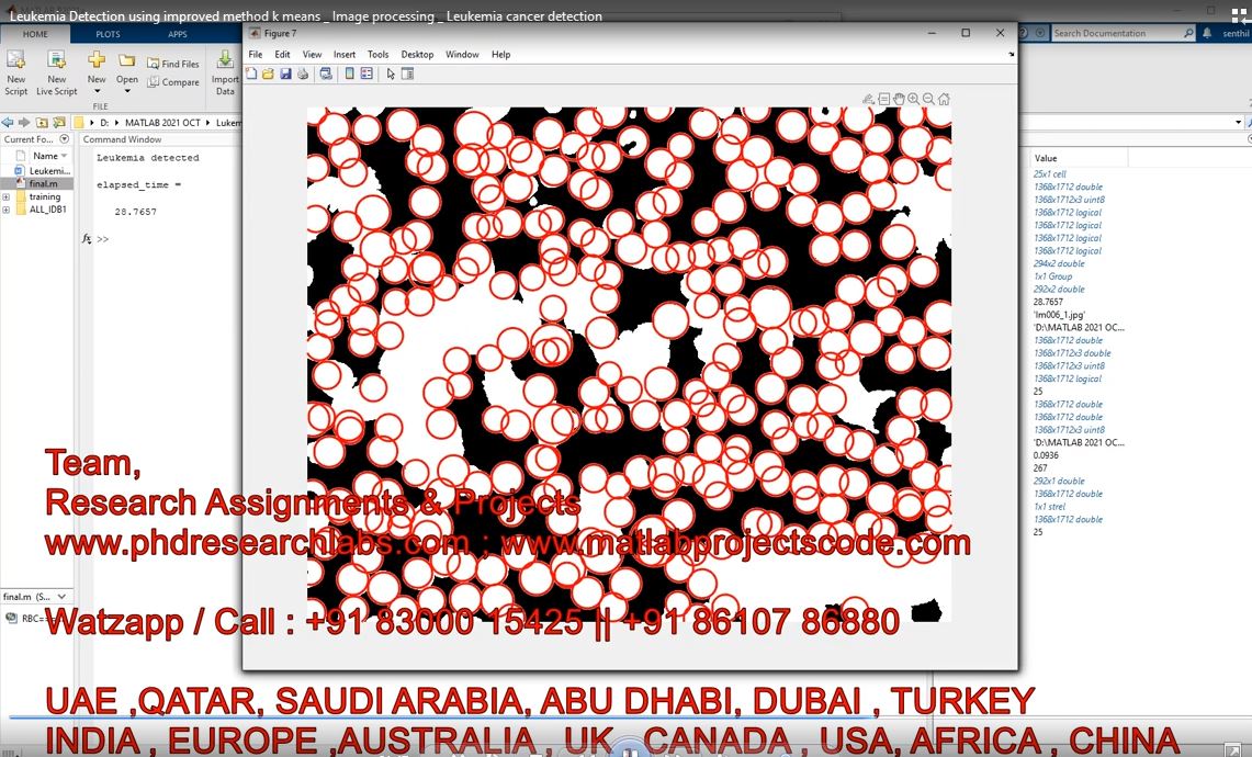 Leukemia Detection Using Improved Method K Means _ Image Processing _ Leukemia Cancer Detection project simulation thumbnail for Signal Processing and AI Engineering