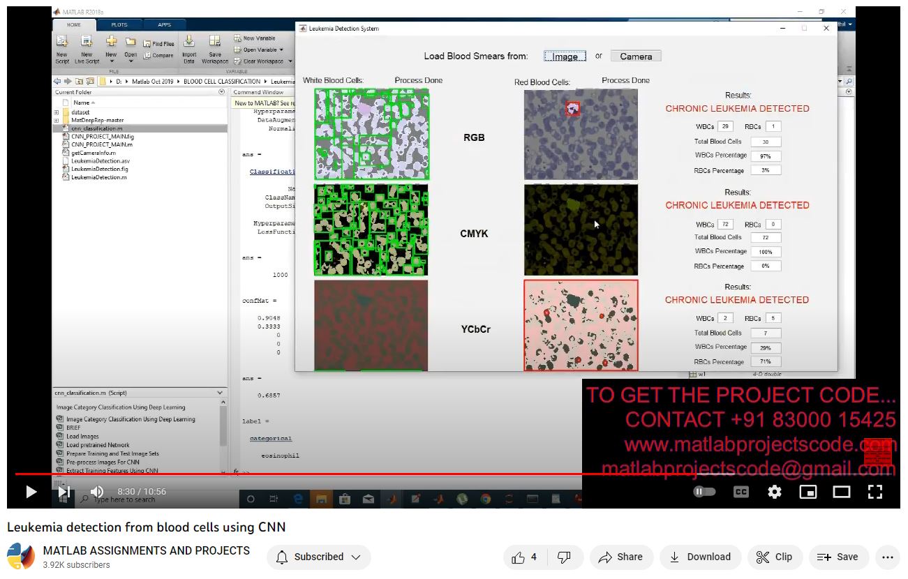 Leukemia Detection From Blood Cells Using Cnn project simulation thumbnail for Signal Processing and AI Engineering