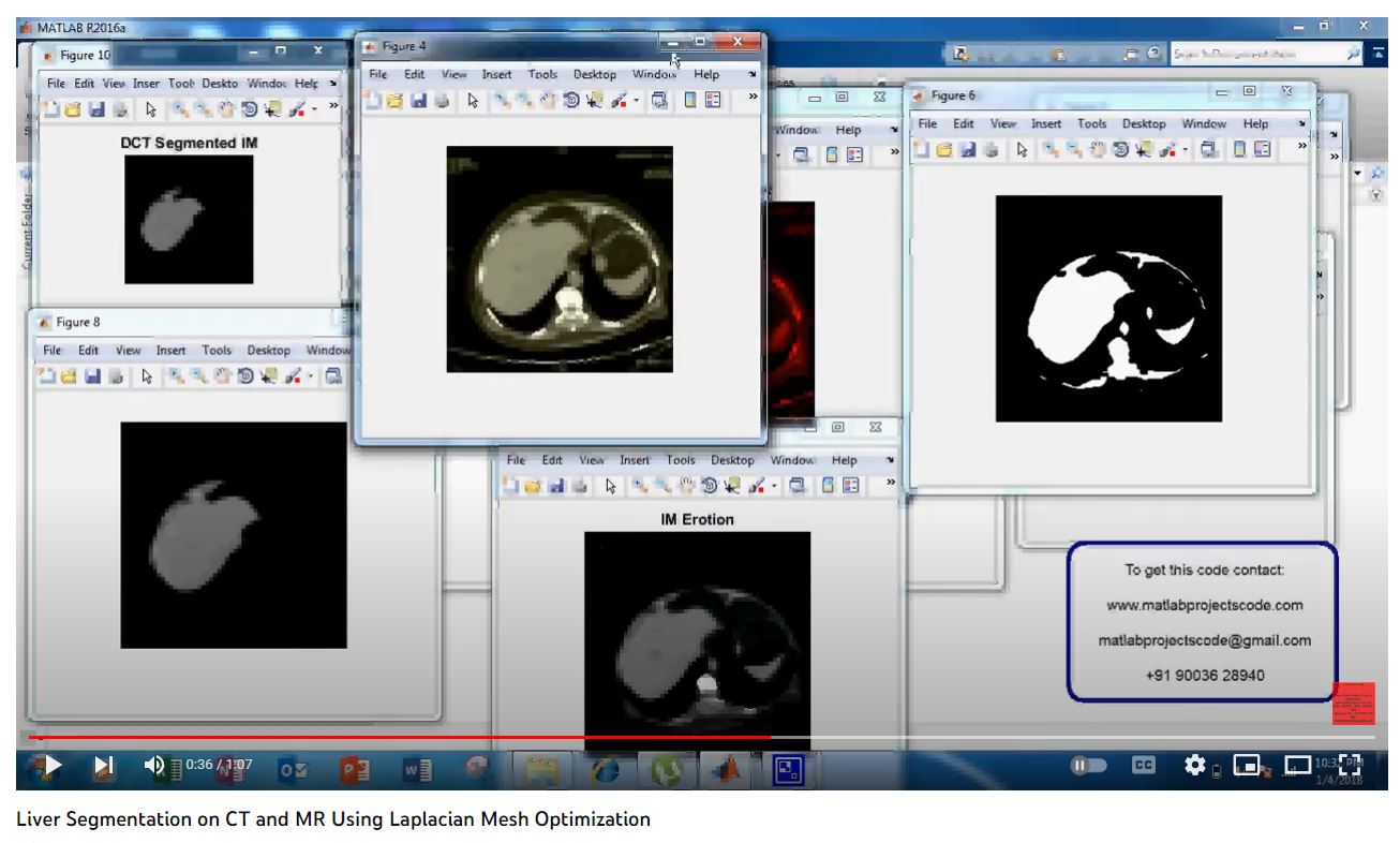 Liver Segmentation on CT and MR using Laplacian Mesh Optimization project simulation thumbnail for Signal Processing and AI Engineering
