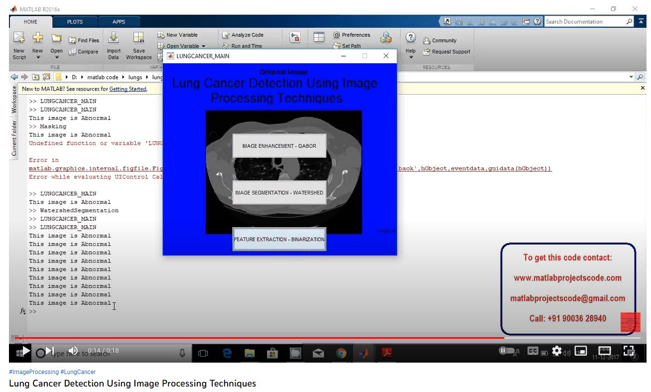 Lung Cancer Detection using Image Processing Techniques project simulation thumbnail for Signal Processing and AI Engineering