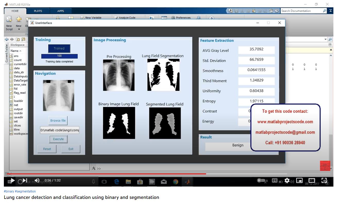 Lung Cancer Detection and Classification using Binary and Segmentation project simulation thumbnail for Signal Processing and AI Engineering