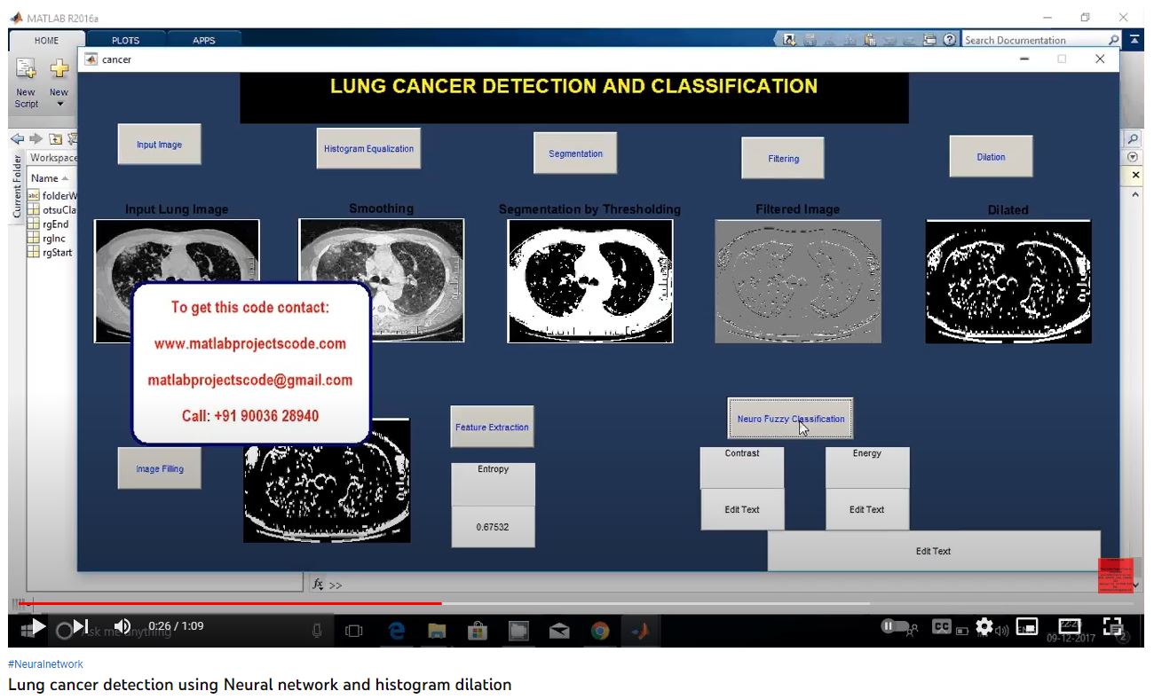 Lung Cancer Detection using Neural Network and Histogram Dilation project simulation thumbnail for Communication Systems Engineering