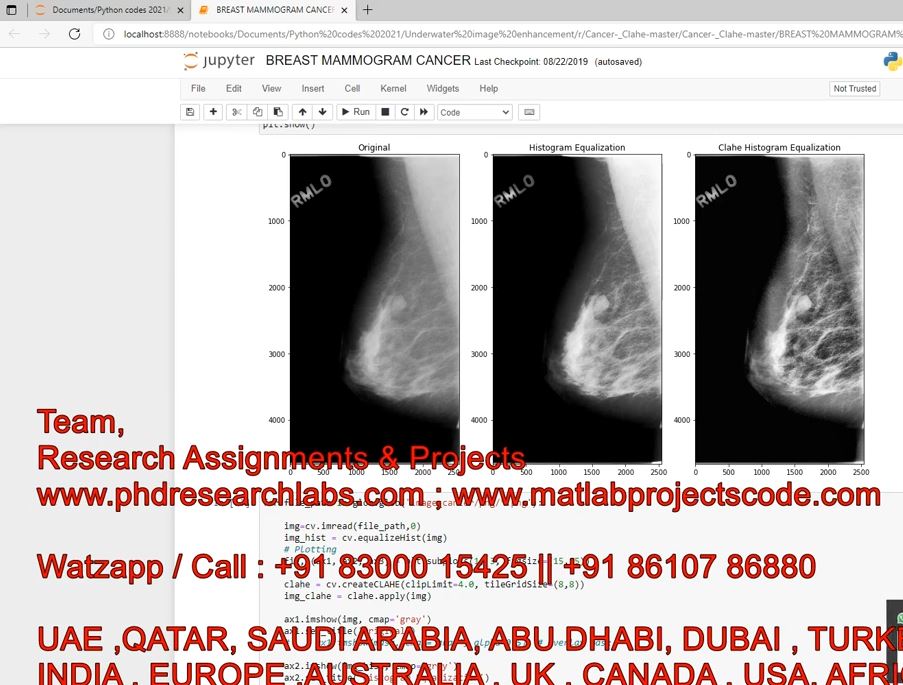 Mammogram Cancer Using Clahe _ Python Code _ Breast Cancer _ Mammogram _ Clahe _ Python Project project simulation thumbnail for Signal Processing and AI Engineering