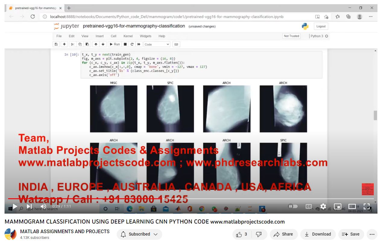 Mammogram Classification Using Deep Learning Cnn Python Code project simulation thumbnail for Signal Processing and AI Engineering