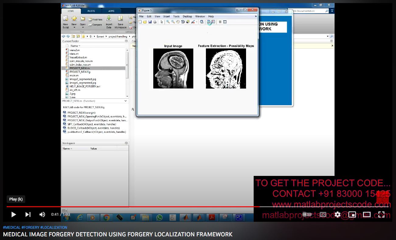 MEDICAL IMAGE FORGERY DETECTION using FORGERY LOCALIZATION FRAMEWORK project simulation thumbnail for Signal Processing and AI Engineering