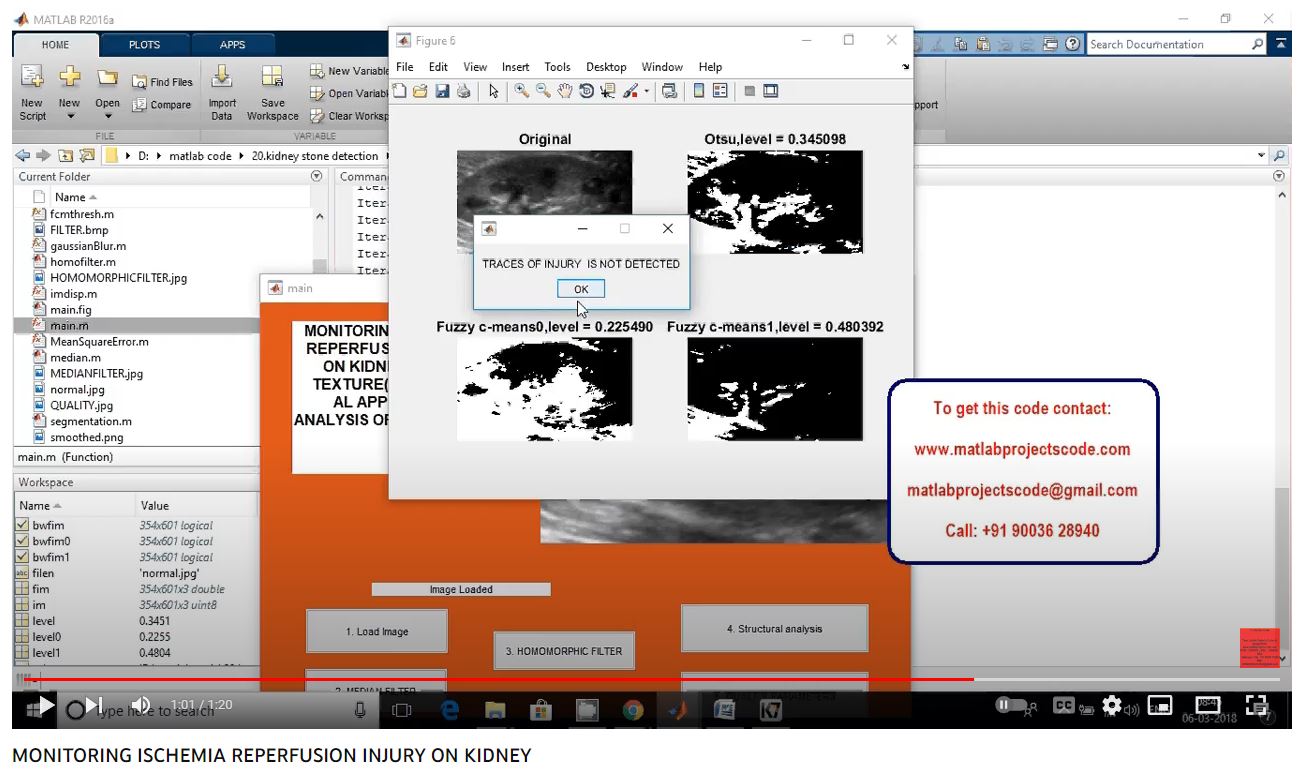 MONITORING ISCHEMIA REPERFUSION INJURY ON KIDNEY project simulation thumbnail for Electromagnetics and RF Engineering