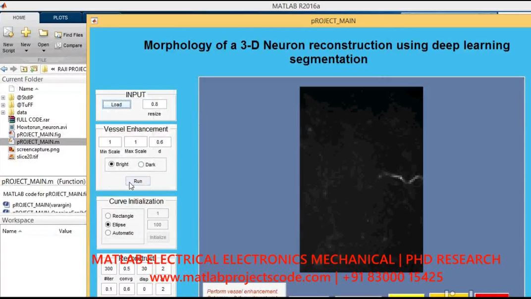 Morphology Of A 3D Neuron Reconstruction Using Deep Learning Segmentation project simulation thumbnail for Signal Processing and AI Engineering