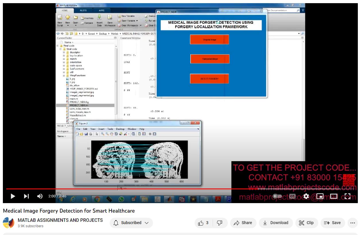 Medical Image Forgery Detection For Smart Healthcare project simulation thumbnail for Signal Processing and AI Engineering