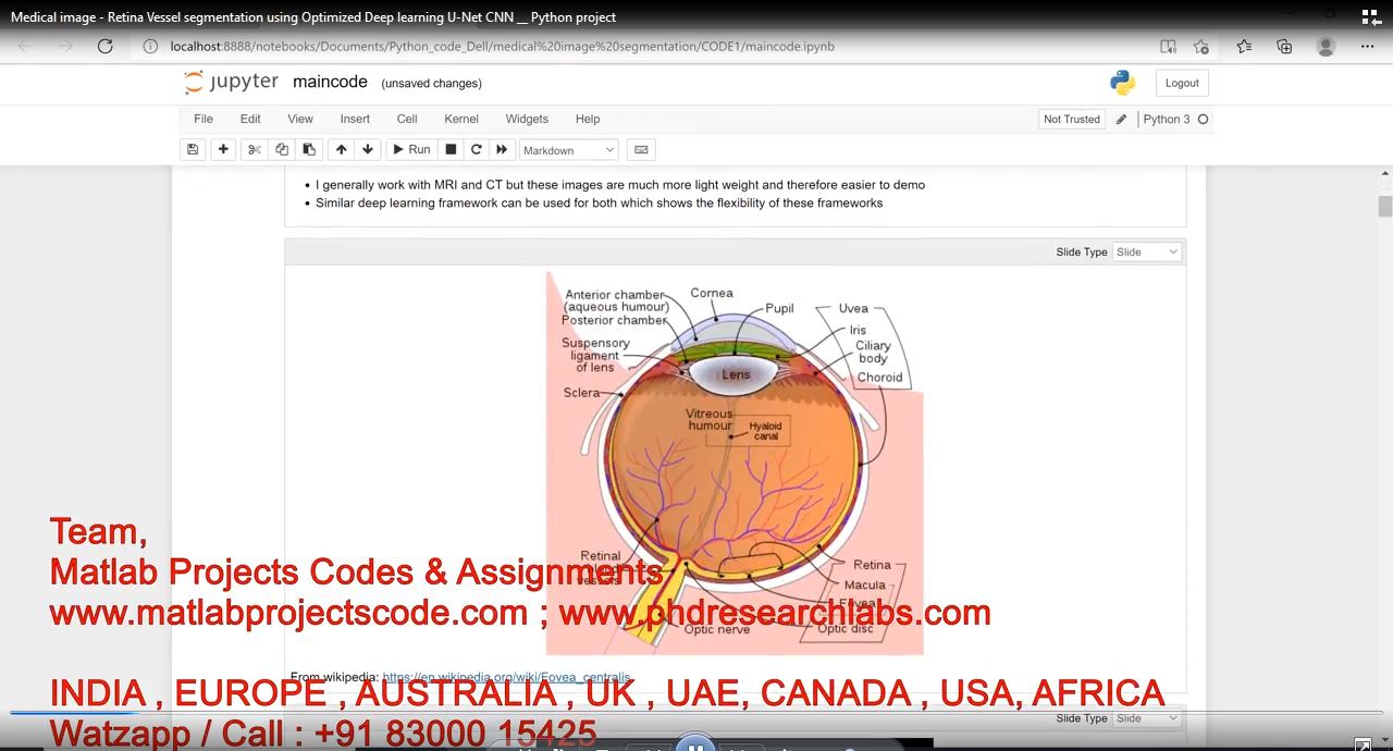 Medical Image - Retina Vessel Segmentation Using Optimized Deep Learning U-Net Cnn __ Python Project project simulation thumbnail for Signal Processing and AI Engineering