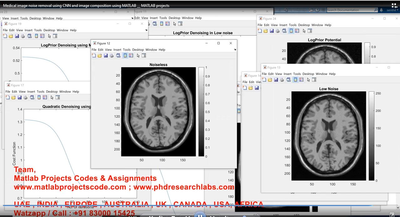 Medical Image Noise Removal Using Cnn And Image Composition Using Matlab __ Matlab Projects project simulation thumbnail for Signal Processing and AI Engineering