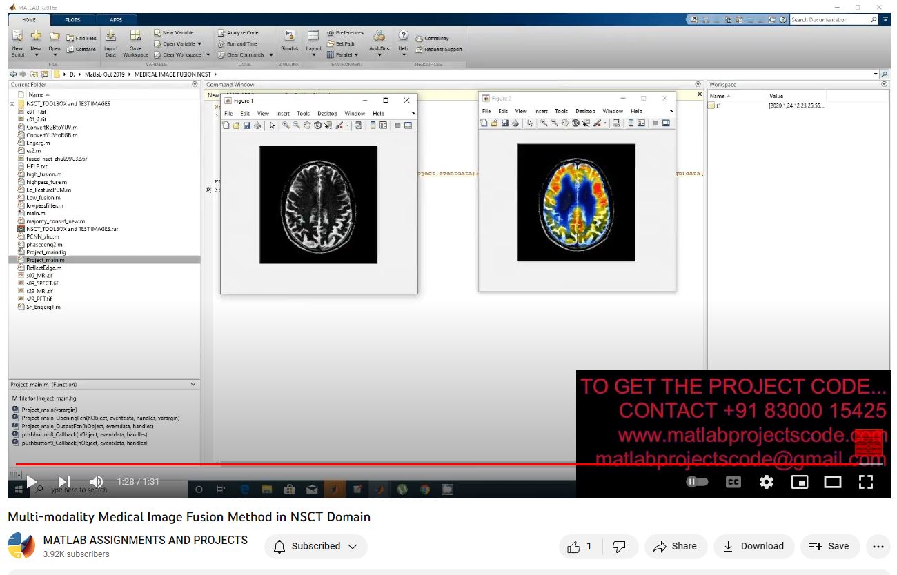 Multi-Modality Medical Image Fusion Method In Nsct Domain project simulation thumbnail for Signal Processing and AI Engineering