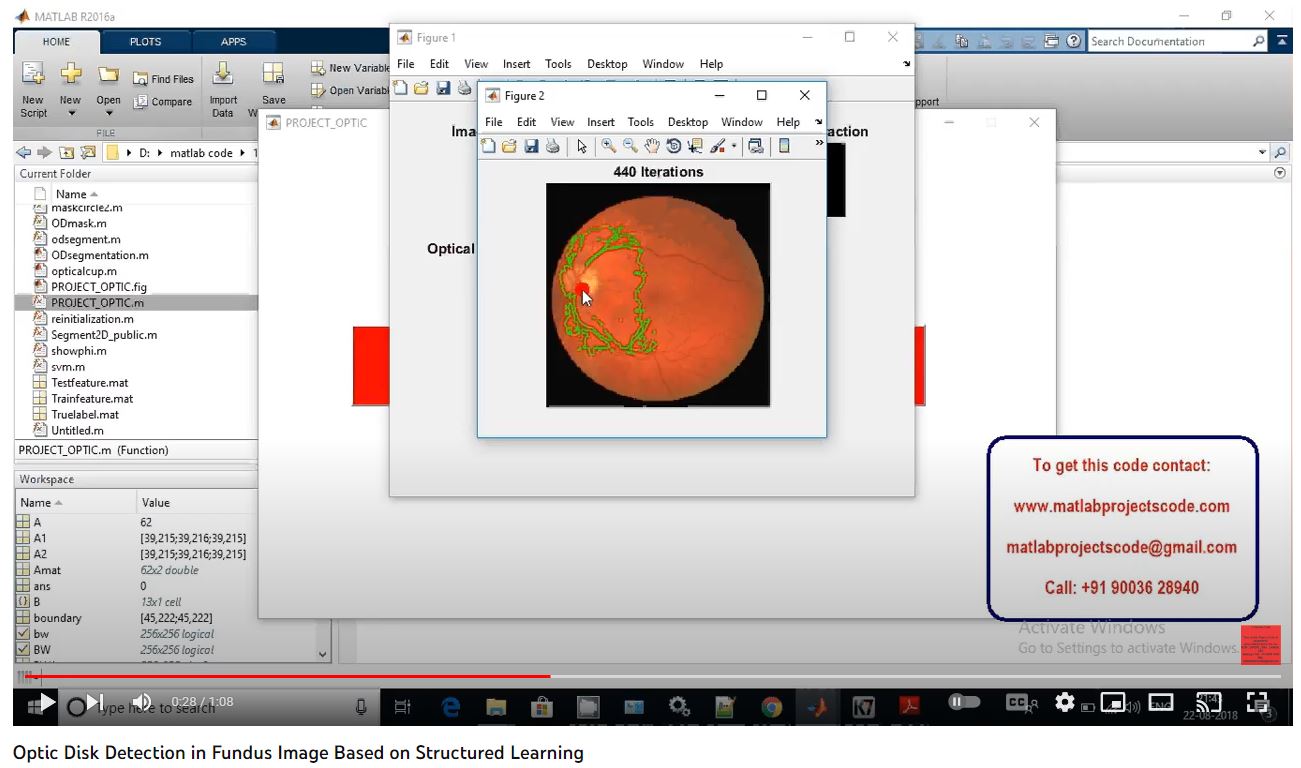 Optic Disk Detection in Fundus Image based on Structured Learning project simulation thumbnail for Signal Processing and AI Engineering