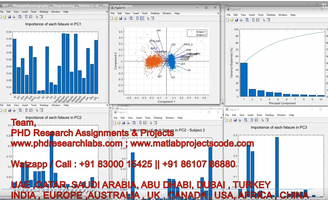 Ppg __ Photoplethysmography __ Deep Learning __ Matlab Code __ Ppg Signal Analysis project simulation thumbnail for Electrical Engineering