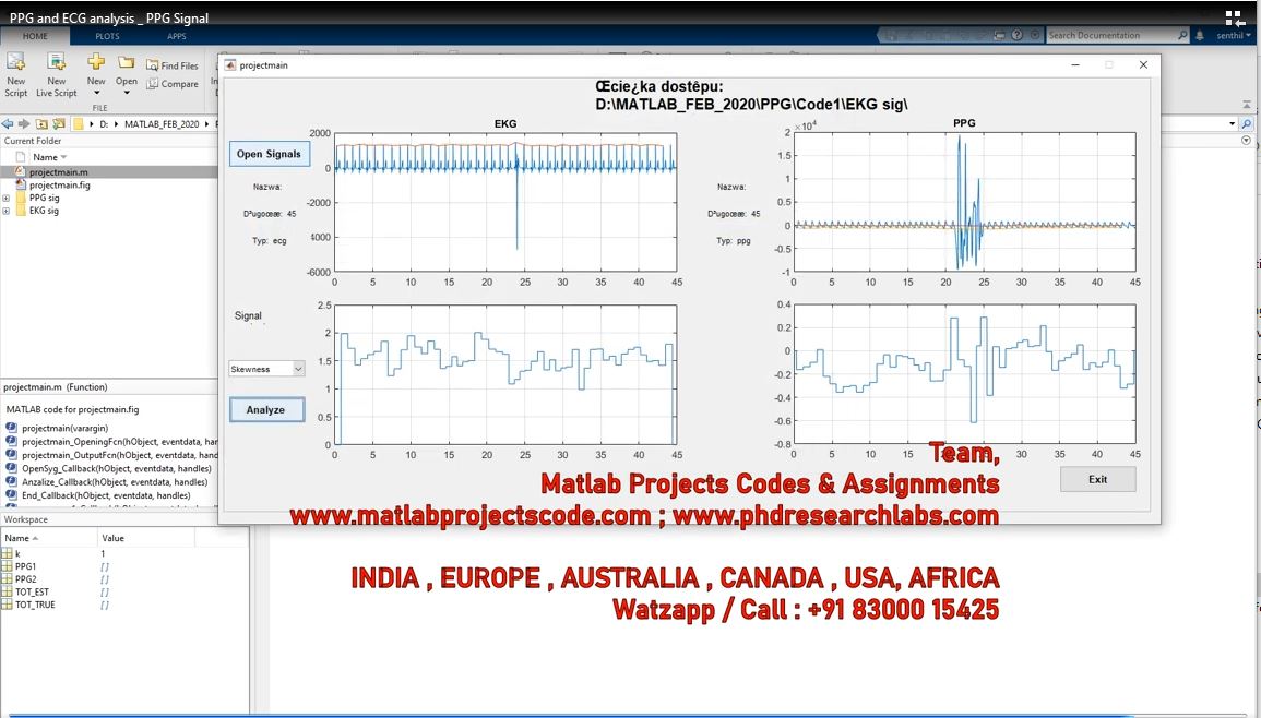 Ppg And Ecg Analysis _ Ppg Signal project simulation thumbnail for Electrical Engineering