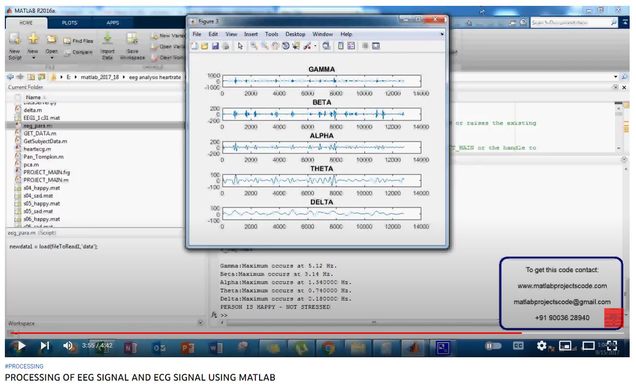 PROCESSING OF EEG SIGNAL AND ECG SIGNAL using MATLAB project simulation thumbnail for Signal Processing and AI Engineering