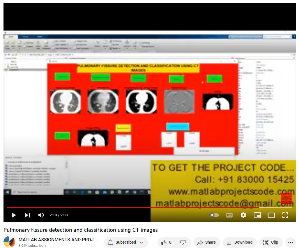 Pulmonary Fissure Detection And Classification Using Ct Images project simulation thumbnail for Signal Processing and AI Engineering