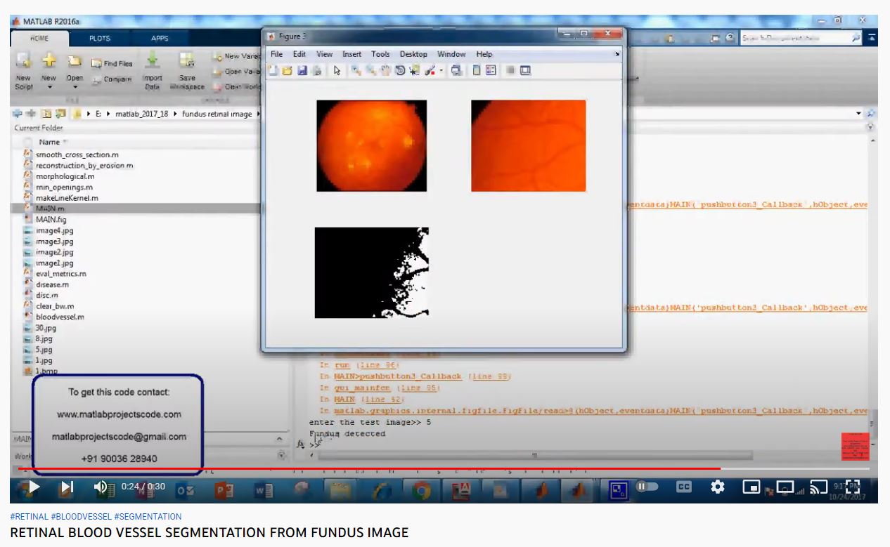 RETINAL BLOOD VESSEL SEGMENTATION FROM FUNDUS IMAGE project simulation thumbnail for Signal Processing and AI Engineering
