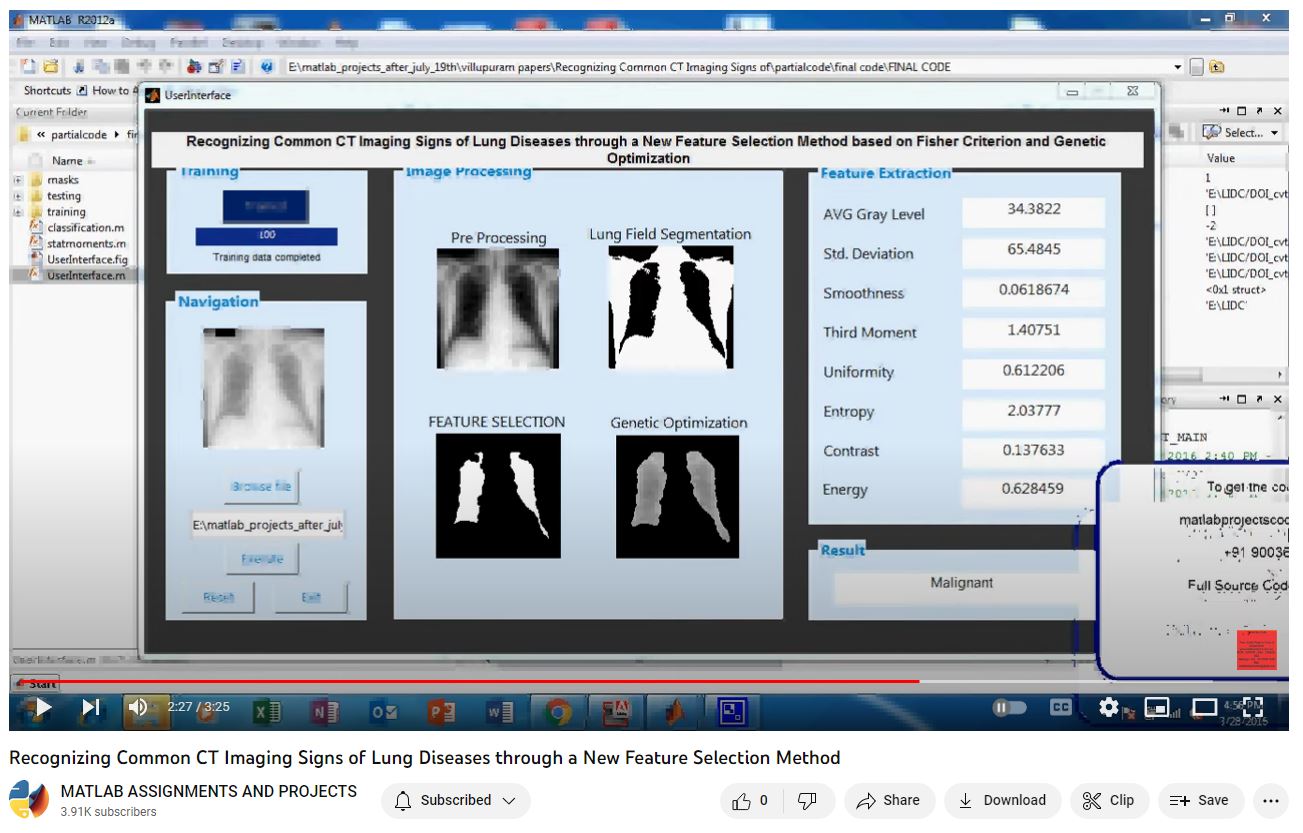 Recognizing Common Ct Imaging Signs Of Lung Diseases Through A New Feature Selection Method project simulation thumbnail for Signal Processing and AI Engineering