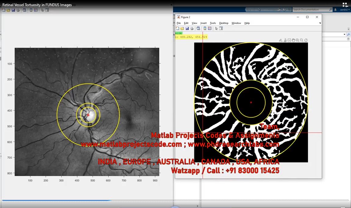 Retinal Vessel Tortuosity In Fundus Images project simulation thumbnail for Signal Processing and AI Engineering