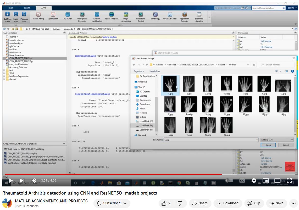 Rheumatoid Arthritis Detection Using Cnn And Resnet50 -Matlab Projects project simulation thumbnail for Signal Processing and AI Engineering
