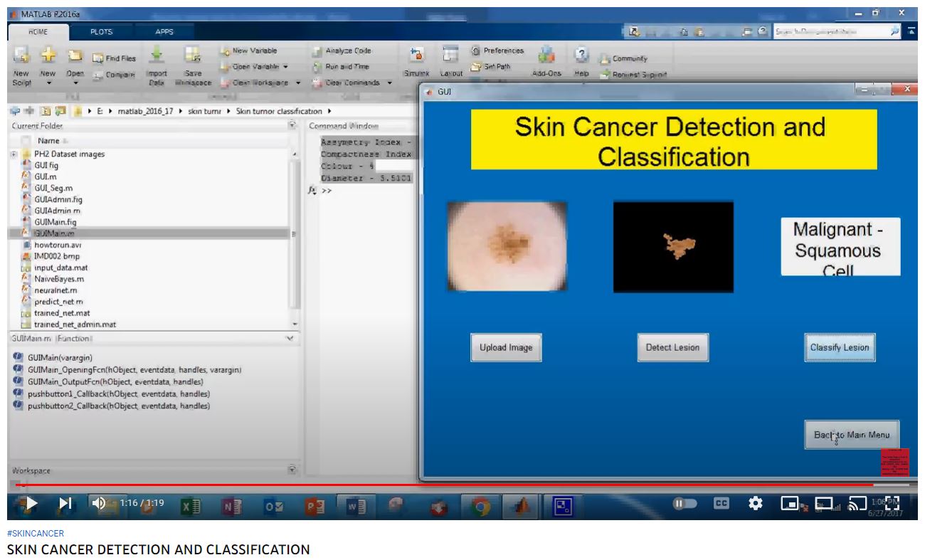 SKIN CANCER DETECTION AND CLASSIFICATION project simulation thumbnail for Signal Processing and AI Engineering