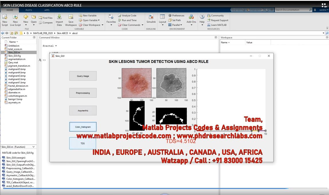 Skin Lesions Disease Classification Abcd Rule project simulation thumbnail for Signal Processing and AI Engineering