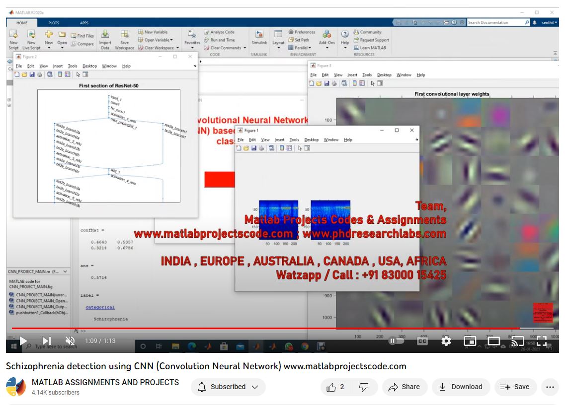 Schizophrenia Detection Using Cnn Convolution Neural Network project thumbnail image