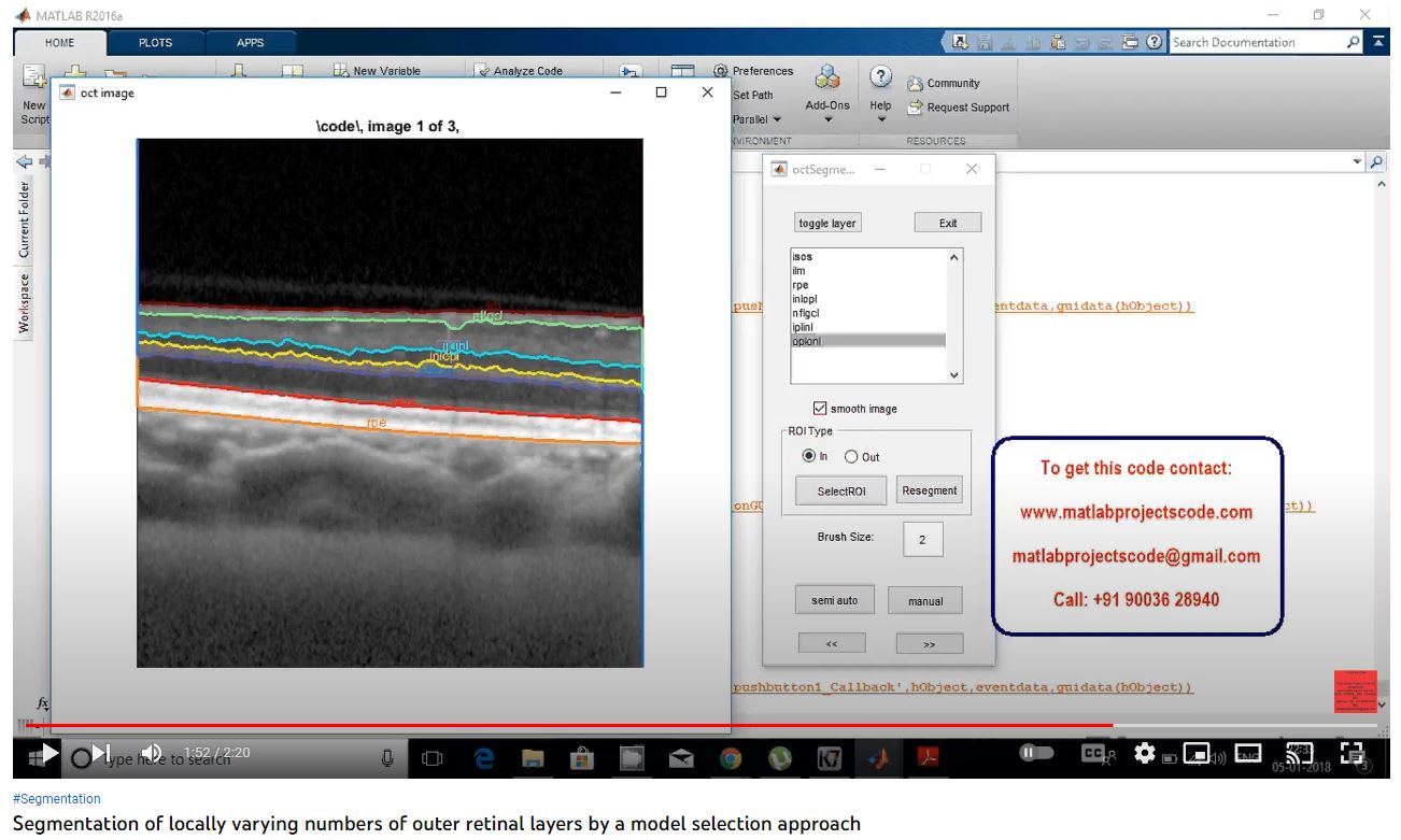 Segmentation of Locally Varying Numbers of Outer Retinal Layers by a Model Selection Approach project simulation thumbnail for Signal Processing and AI Engineering