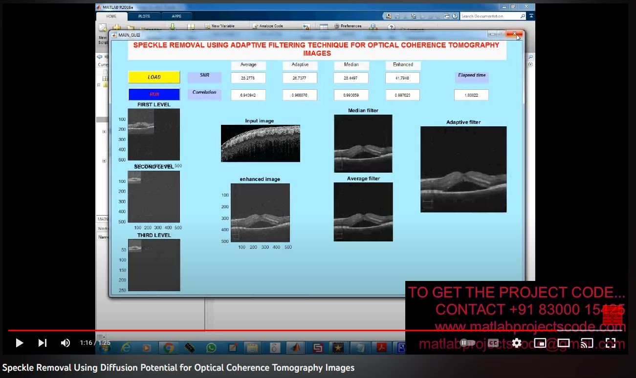 Speckle Removal Using Diffusion Potential For Optical Coherence Tomography Images project simulation thumbnail for Signal Processing and AI Engineering