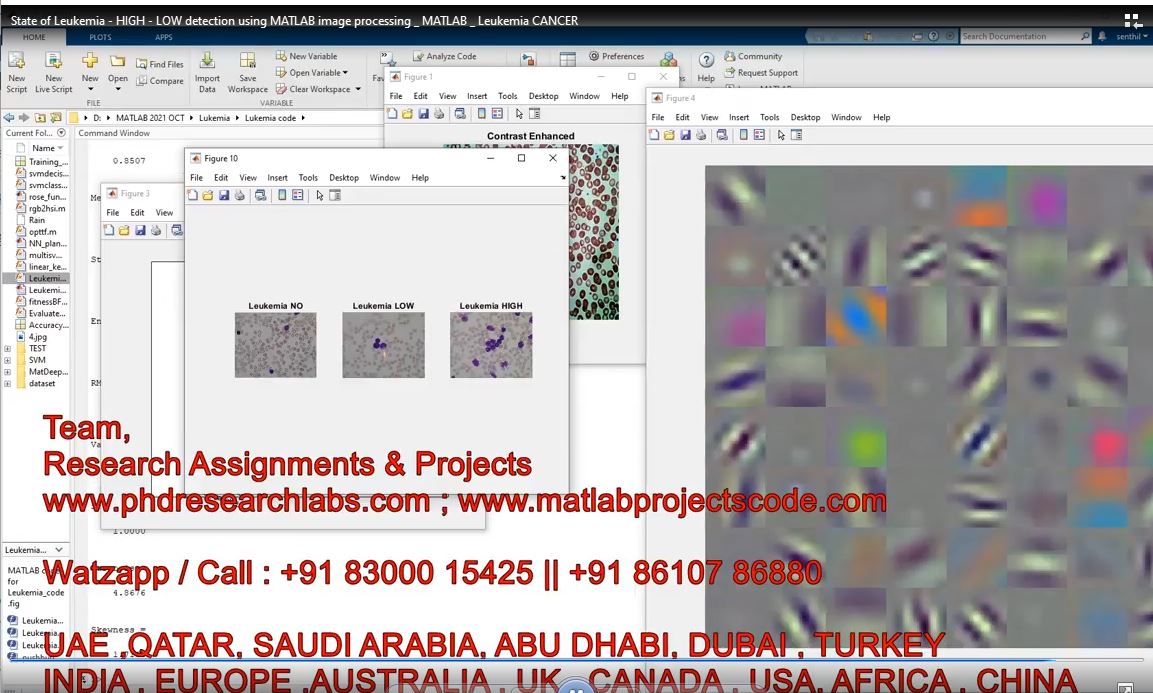 State Of Leukemia - High - Low Detection Using Matlab Image Processing _ Matlab _ Leukemia Cancer project simulation thumbnail for Signal Processing and AI Engineering