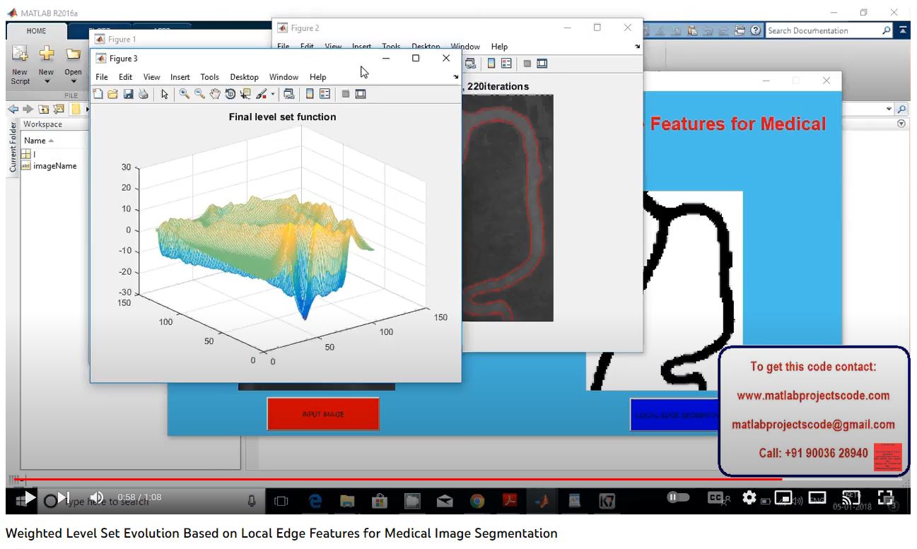 Weighted Level Set Evolution based on Local Edge Features for Medical Image Segmentation project simulation thumbnail for Signal Processing and AI Engineering