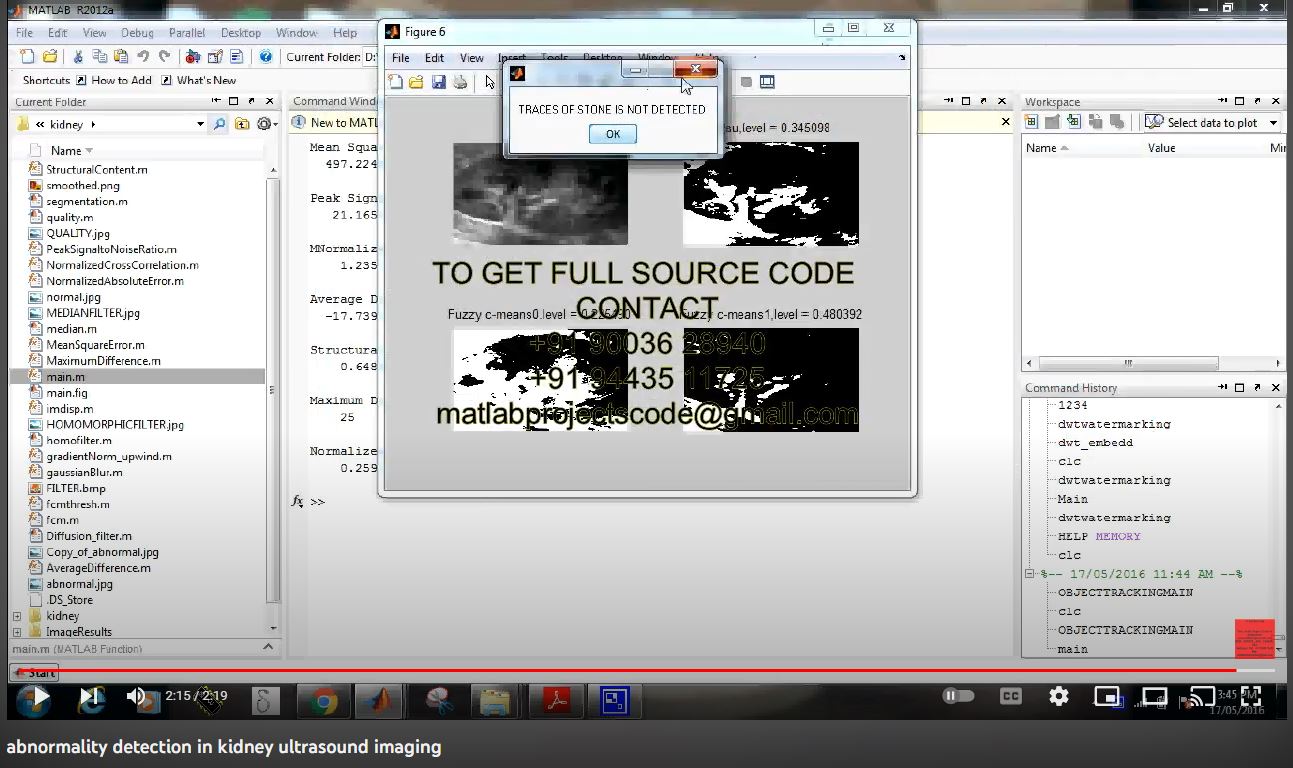 Abnormality Detection in Kidney Ultrasound Imaging project simulation thumbnail for Signal Processing and AI Engineering