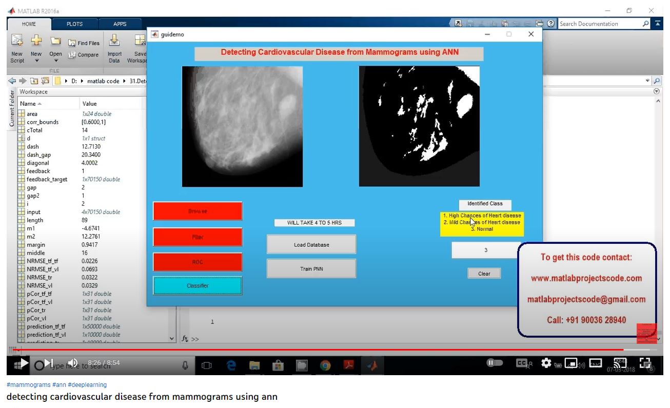 Detecting Cardiovascular Disease from Mammograms using ANN project simulation thumbnail for Signal Processing and AI Engineering