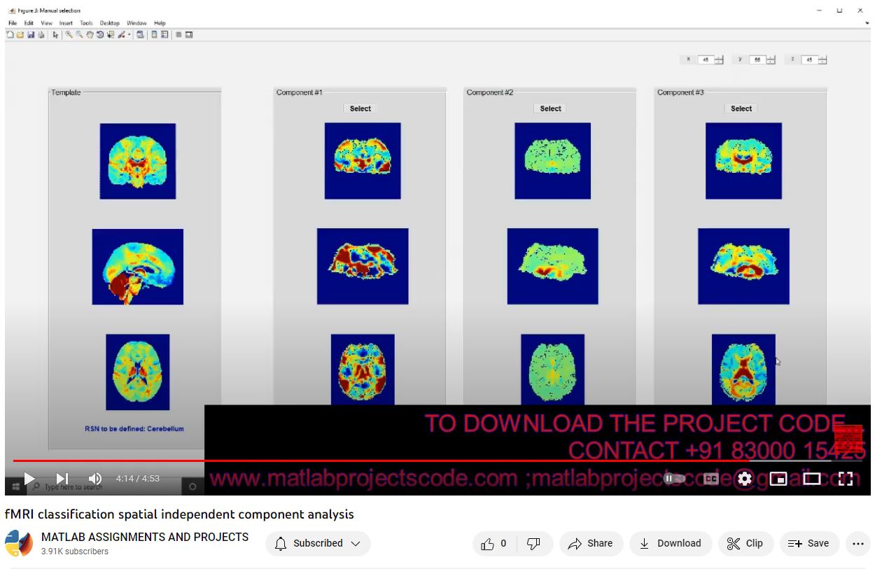 Fmri Classification Spatial Independent Component Analysis project simulation thumbnail for Signal Processing and AI Engineering