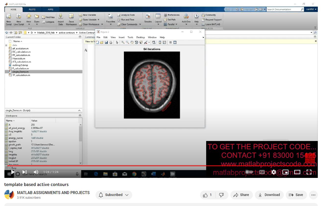 Template Based Active Contours project simulation thumbnail for Electrical Engineering